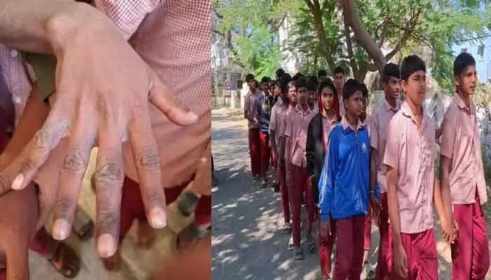 Students in Medchal protested against poor facilities, contaminated water, and lack of proper meals in Gurukula schools. Officials inspected and submitted a report.